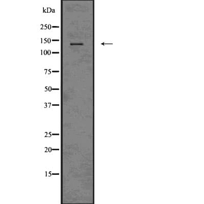 ITGAX / CD11c Antibody