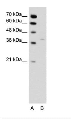 HSD17 / HSD17B1 Antibody (N-Terminus)