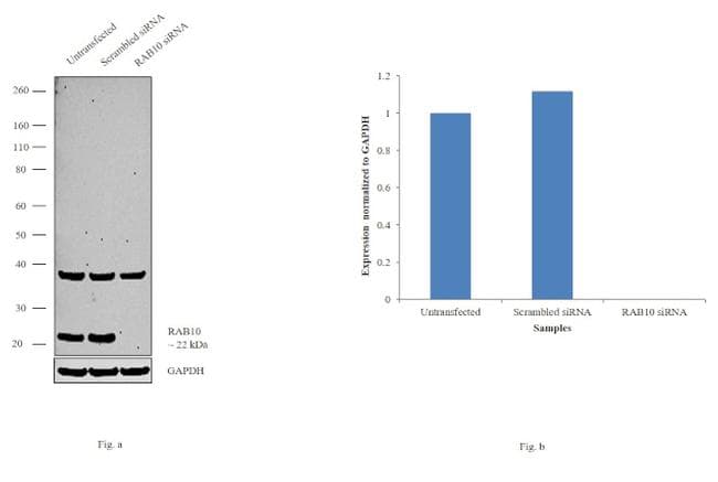 RAB10 Antibody (clone 400)