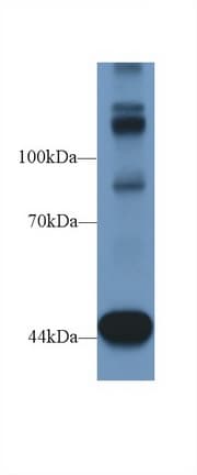 TNS1 / Tensin-1 Antibody (aa4-307, APC)