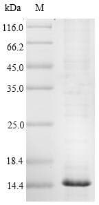 Mouse TTR / Transthyretin Protein (Recombinant 6His, N-terminus)