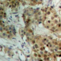 STAT4 Antibody (C-Terminus)