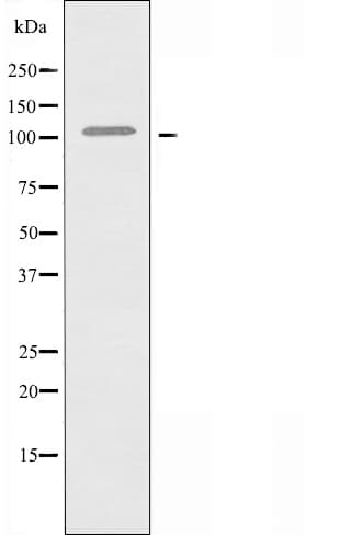 MLLT10 Antibody