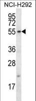 FBXO15 / FBX15 Antibody (aa130-158)