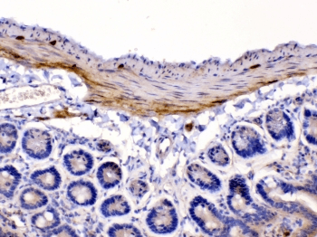 CHRNA5 Antibody