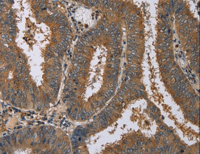 DNAJA1 / HDJ2 Antibody