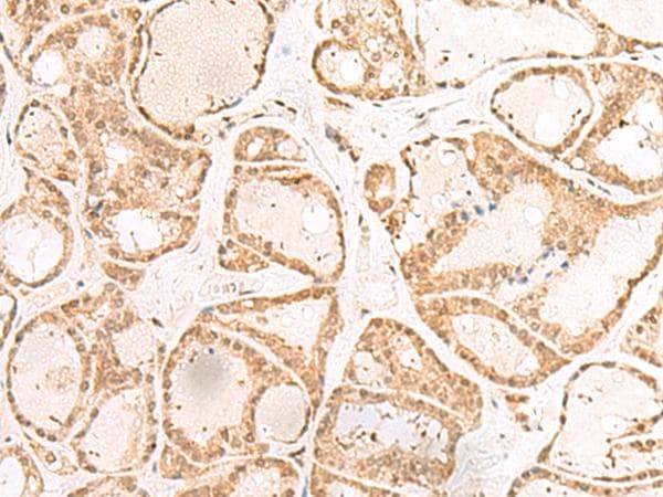 RBM19 Antibody