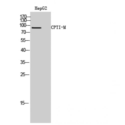Polyclonal Rabbit anti-Human CPT1B Antibody (370-450 aa, Internal, IHC, WB)