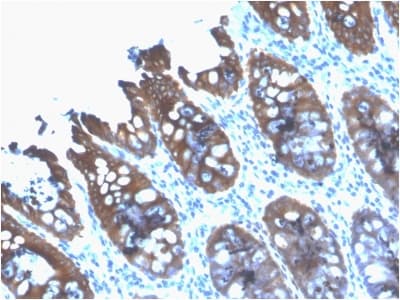 KRT8 / CK8 / Cytokeratin 8 Antibody (clone rB22.1, Azide-free, Carrier-free)