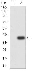 P2RY12 / P2Y12 Antibody (clone 1C2A9)