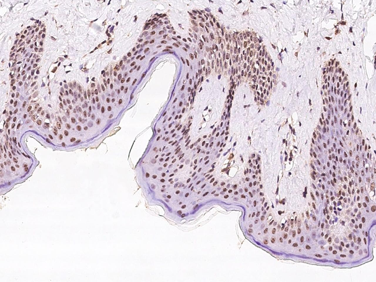Polyclonal Rabbit anti-Human EXOSC7 Antibody (IHC)