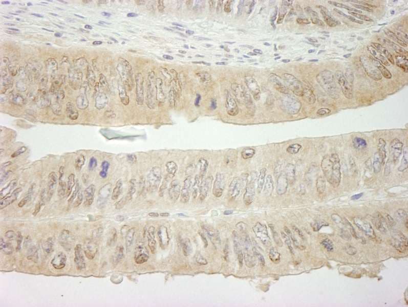 SYK Antibody (aa250-300)