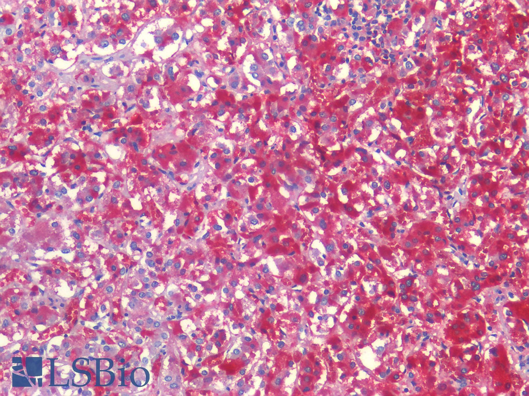 PathPlus™ Monoclonal Mouse anti-Human TIMP2 Antibody (clone 5B11, IHC, IF, WB)