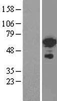 Human FOXC2 Protein (Over-Expression Lysate Myc-DDK (Flag))