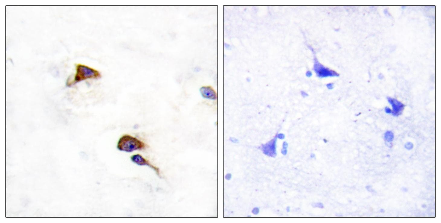 PPIF / Cyclophilin F Antibody