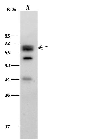 CAMK4 / CaMK IV Antibody (Preservative Free)
