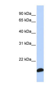PRDX5 / Peroxiredoxin 5 Antibody (C-Terminus)