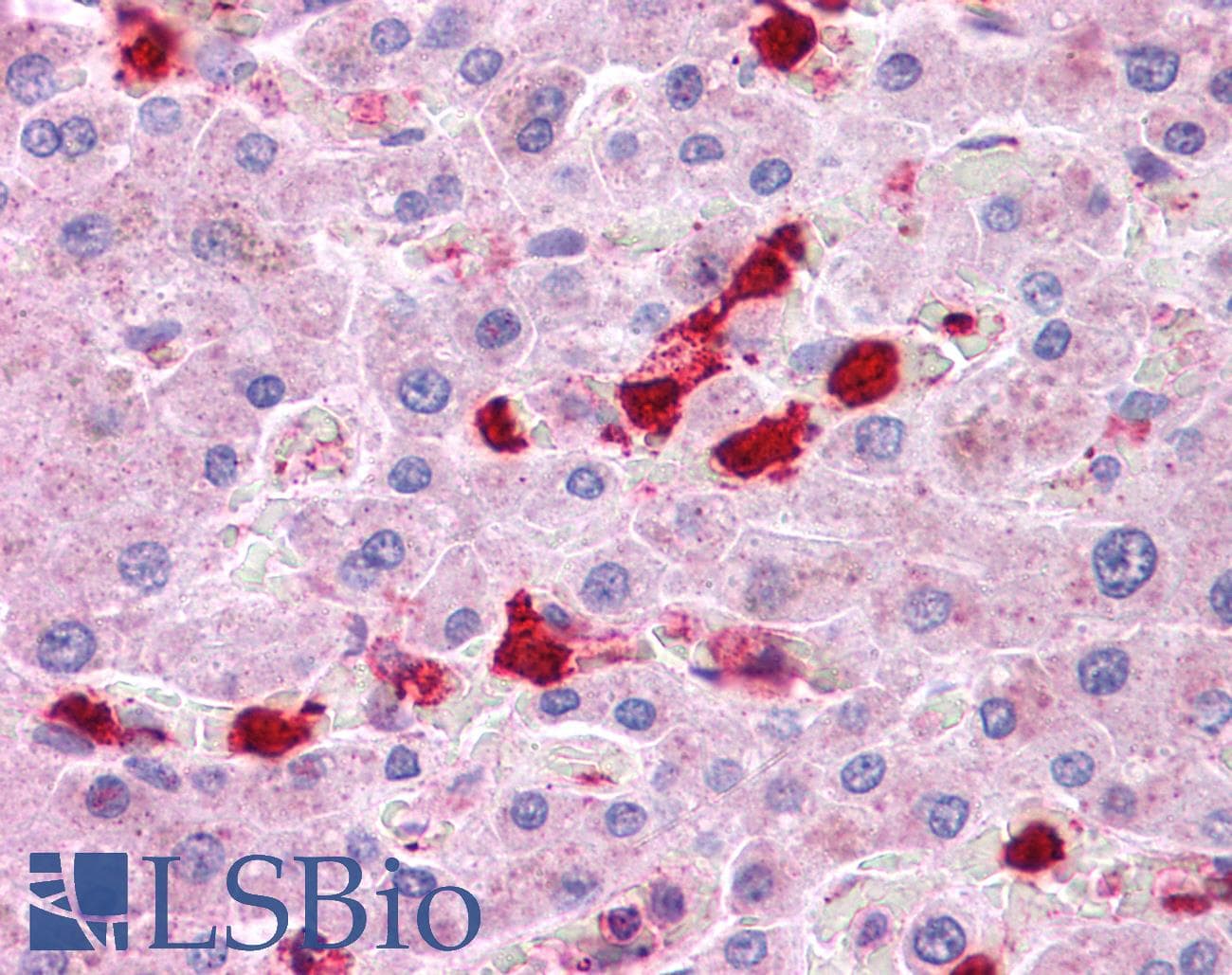 Polyclonal Rabbit anti-Human LRRC8B Antibody (aa542-591, IHC, WB)