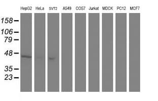 ACY1 / Aminoacylase 1 Antibody (clone OTI1D4)