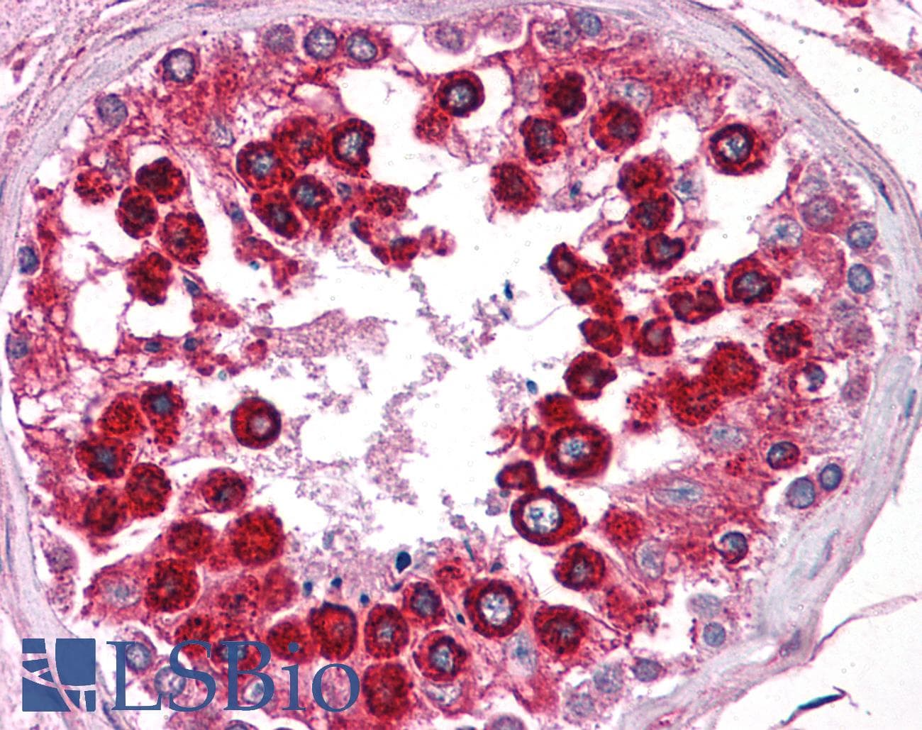 PathPlus™ CANX / Calnexin Antibody