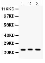 PRDX5 / Peroxiredoxin 5 Antibody (aa66-198)