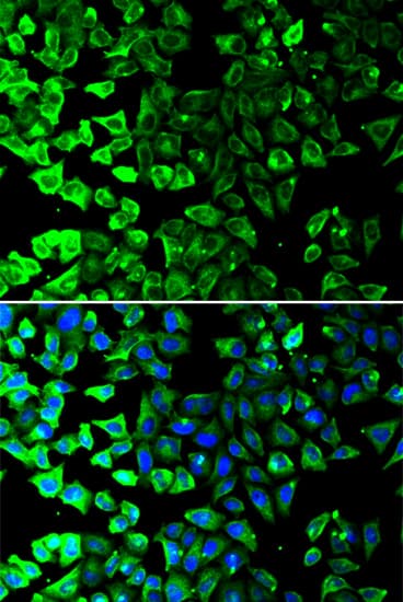 KRT8 / CK8 / Cytokeratin 8 Antibody