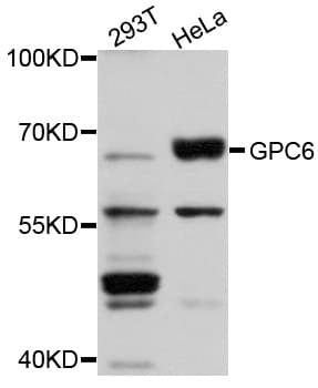IHC-plus™ GPC6 / Glypican 6 Antibody