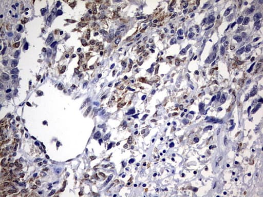 ALDP / ABCD1 Antibody (aa508-745, clone OTI4C2)