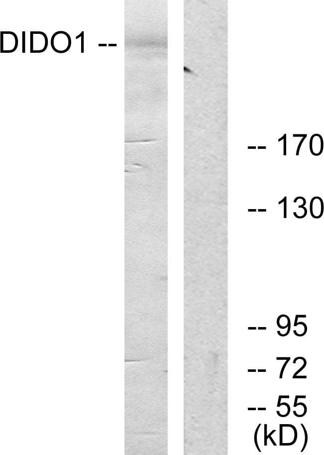 DATF1 / DIDO1 Antibody