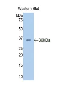 PCSK9 Antibody (aa156-461, HRP)