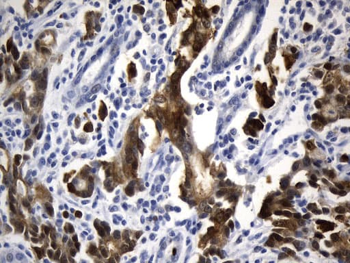 VIL1 / Villin Antibody (aa1-188, clone UMAB230)