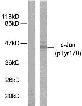 JUN / c-Jun Antibody (phospho-Tyr170)