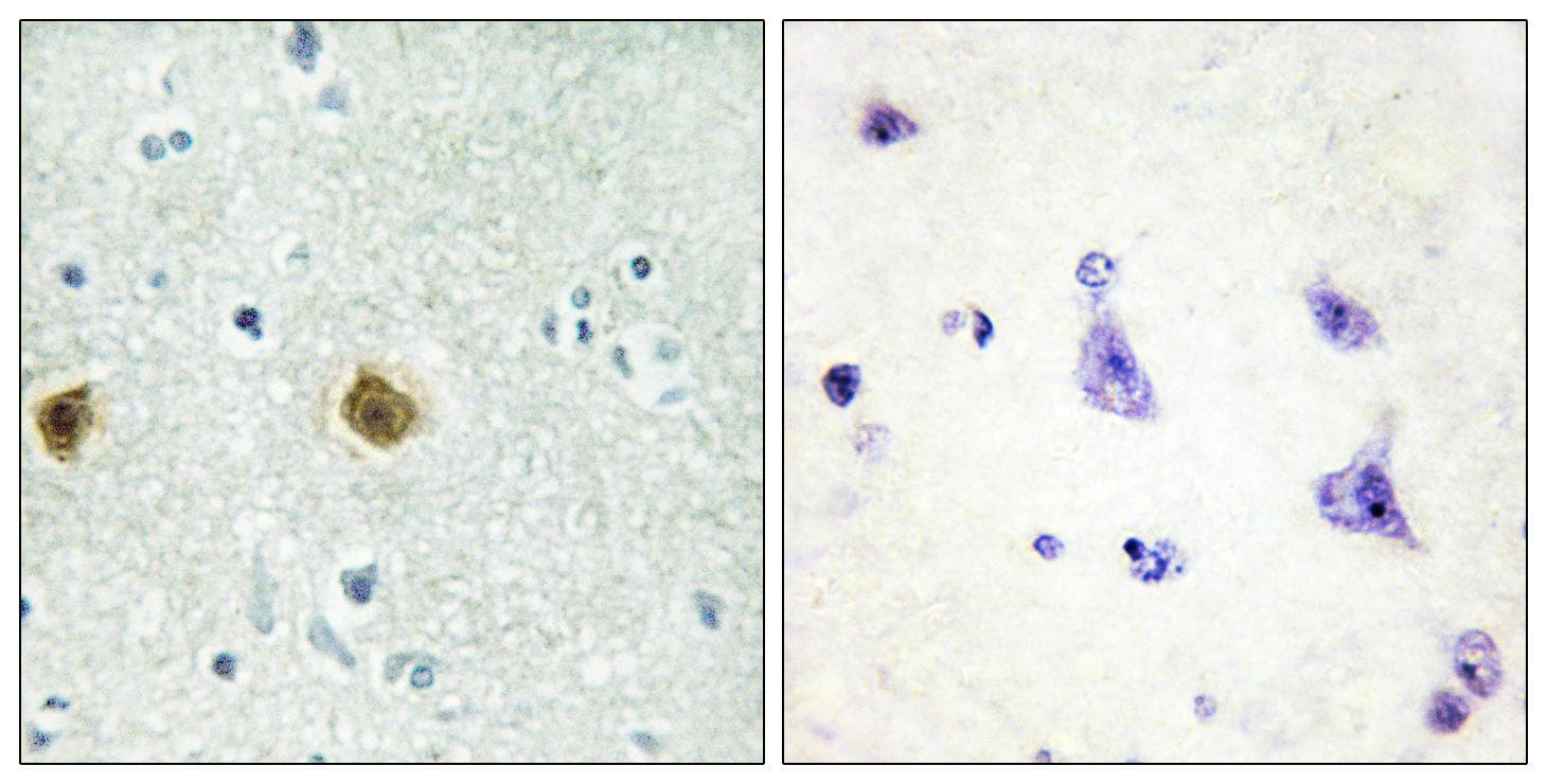 NDUFC2 Antibody (aa51-100)
