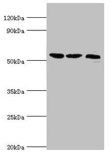 Polyclonal Rabbit anti-Human SMYD1 Antibody (aa1-350, IHC, WB)