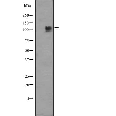 Polyclonal Rabbit anti-Human PIK3CD / PI3K Delta Antibody (WB)
