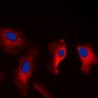 MAST3 Antibody (C-Terminus)