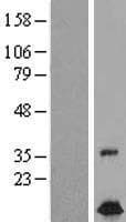 TIMM10B / FXC1 Protein (Over-Expression Lysate Myc-DDK (Flag))