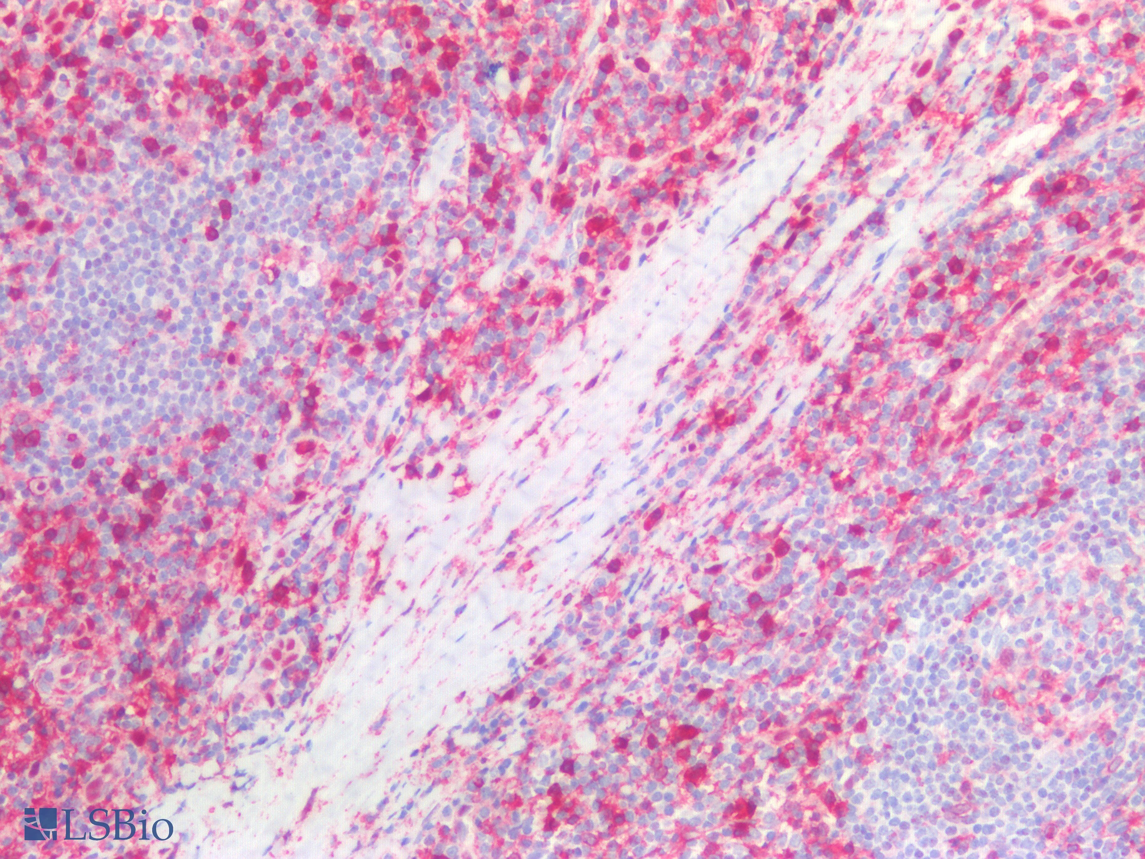IHC-plus™ Polyclonal Rabbit anti-Human ANXA1 / Annexin A1 Antibody (Internal, IHC, IF, WB)