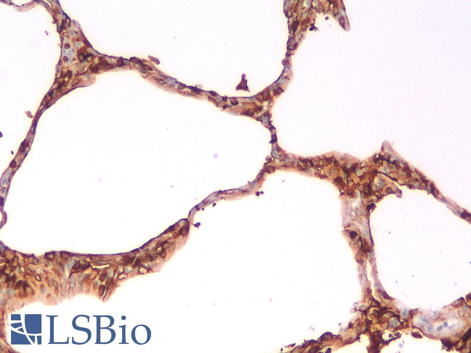 PathPlus™ EMA / MUC1 Antibody (clone rMUC1/960)
