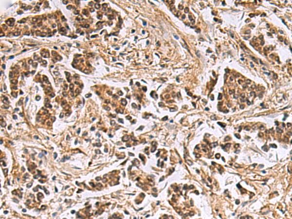 DNA2 Antibody