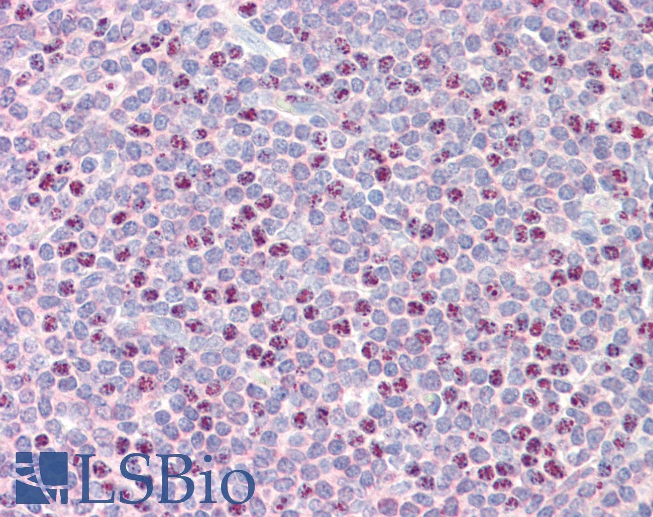 Polyclonal Rabbit anti-Human RAD51B Antibody (aa143-192, IHC, WB)