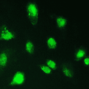 KBTBD2 Antibody