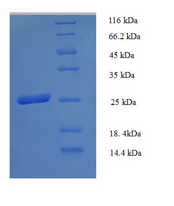 Human HLA-DPB1 Protein (Recombinant 6His, N-terminus)