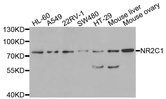 Polyclonal Rabbit anti-Human NR2C1 Antibody (WB)