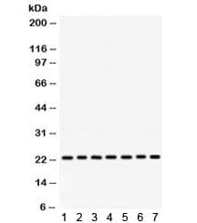 RALB Antibody