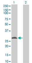 RAD1 Antibody (clone 1G2)