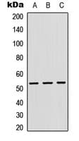 CTSF / Cathepsin F Antibody (Internal)