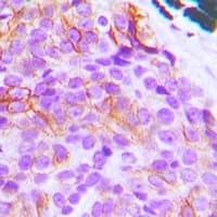 BCL2L11 / BIM Antibody (N-Terminus)