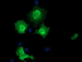 Monoclonal Mouse anti-Human EPM2AIP1 Antibody (clone OTI5G8, IF, WB)