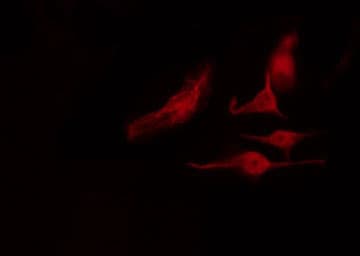 Polyclonal Rabbit anti-Human HNRNPK / hnRNP K Antibody (phospho-Ser284, IF, WB)